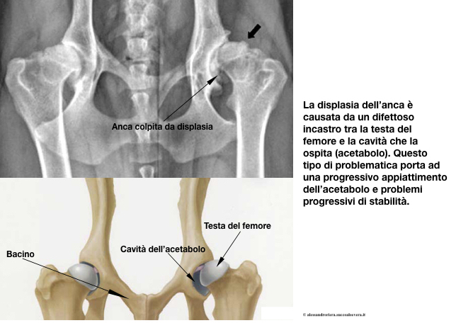 displasia anca.001.jpeg